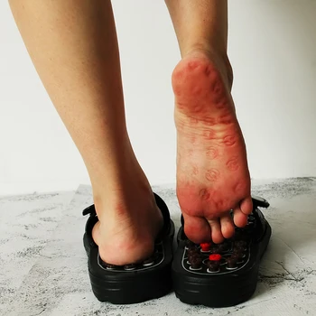 Acupoint Masaža Copate Moške/Ženske Sandale Stopal, Kitajske Akupresure Terapija Medicinske Obračanje Stopala Massager Čevlji za Moške Spolne