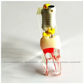CMAM/12587 Zobne zdravljenju koreninskega kanala praksi, 5pc/paket, Človekove Ustni Zobni Medicinske Poučevanja Anatomski Model