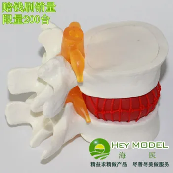 Ledvene hrbtenice model človeškega ledvenega diska herniation model človeški skelet modela